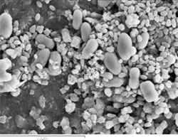bacteria build-up on filters